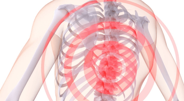 pijn in de wervelkolom met thoracale osteochondrose
